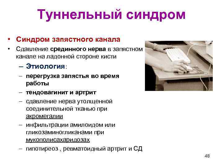 Туннельный синдром • Синдром запястного канала • Сдавление срединного нерва в запястном канале на