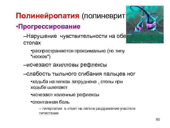 Алкогольная полинейропатия что это такое. Полиневрит, полинейропатия,. Полинейропатия нарушение чувствительности. Полинейропатия Тип нарушения чувствительности. Полиневропатический Тип расстройства чувствительности.