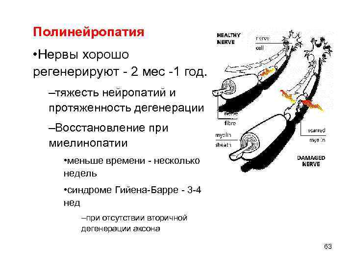 Полинейропатия • Нервы хорошо регенерируют - 2 мес -1 год. –тяжесть нейропатий и протяженность