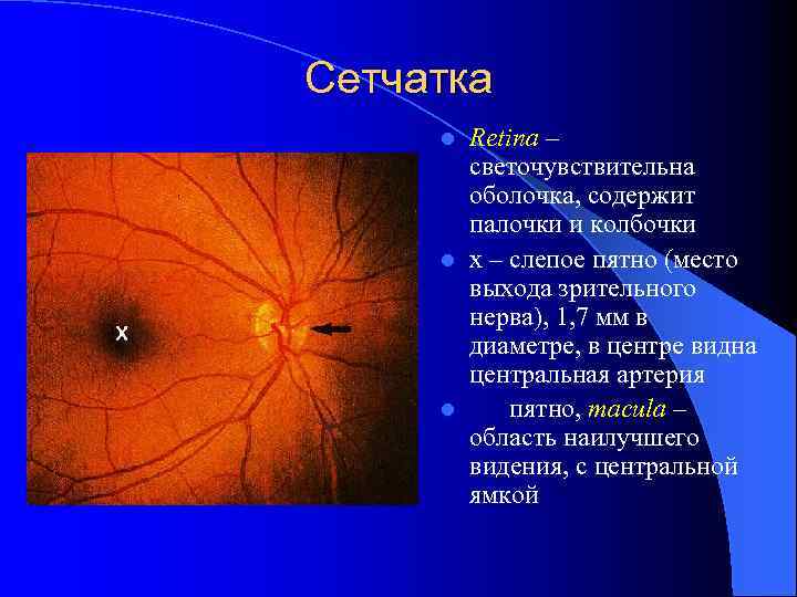 Сетчатка Retina – светочувствительна оболочка, содержит палочки и колбочки l x – слепое пятно
