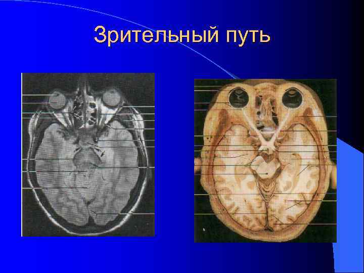 Зрительный путь 