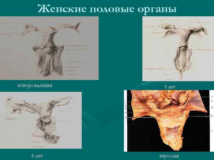 Женские половые органы новорожденная 9 лет 5 лет взрослая 