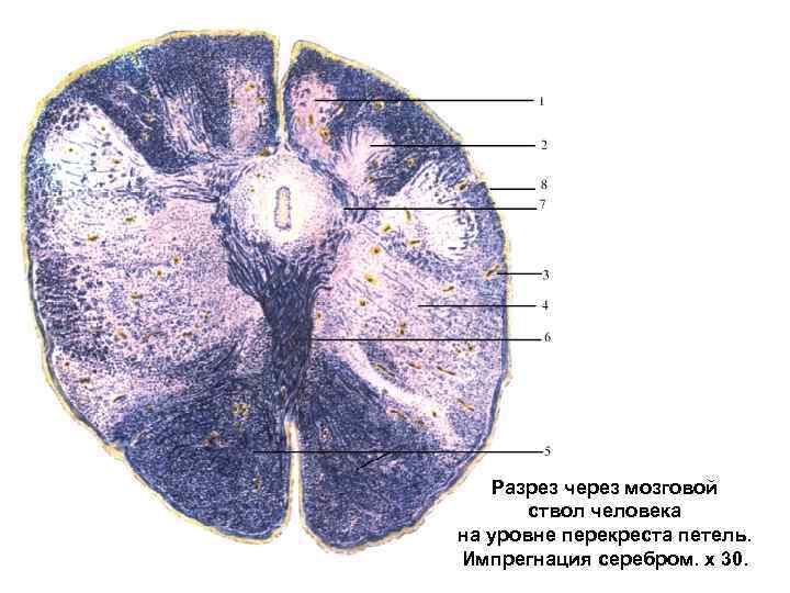 Разрез через мозговой ствол человека на уровне перекреста петель. Импрегнация серебром. х 30. 
