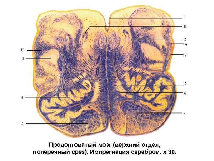 Продолговатый мозг (верхний отдел, поперечный срез). Импрегнация серебром. х 30. 