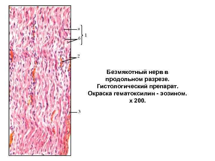 Безмякотный нерв в продольном разрезе. Гистологический препарат. Окраска гематоксилин - эозином. x 200. 