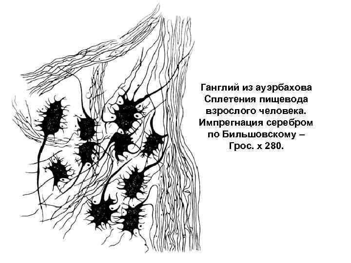 Ганглий из ауэрбахова Сплетения пищевода взрослого человека. Импрегнация серебром по Бильшовскому – Грос. х