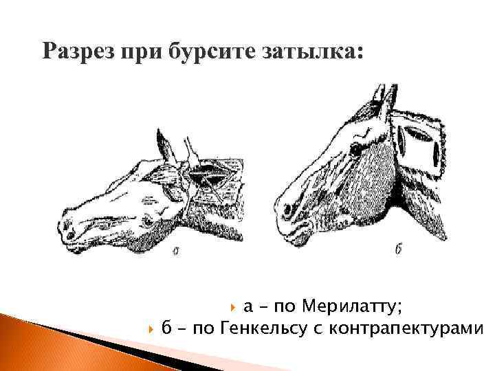 Разрез при бурсите затылка: а – по Мерилатту; б – по Генкельсу с контрапектурами