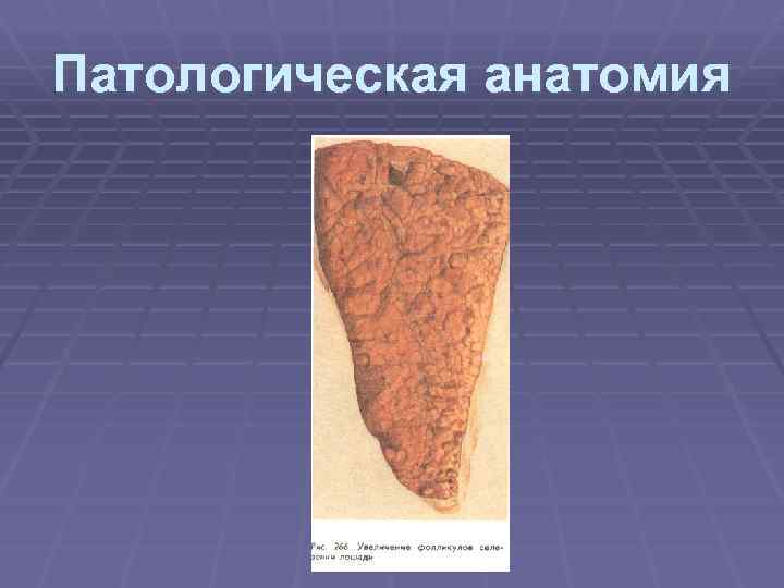 Патологическая анатомия 