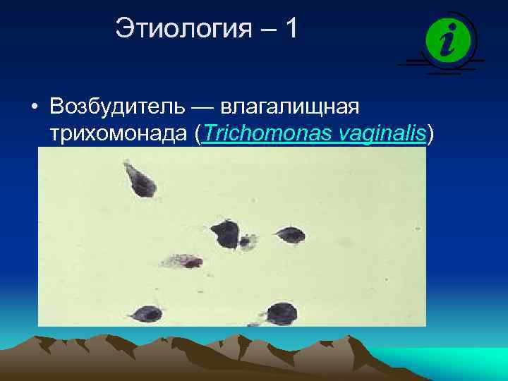 Этиология – 1 • Возбудитель — влагалищная трихомонада (Trichomonas vaginalis) 