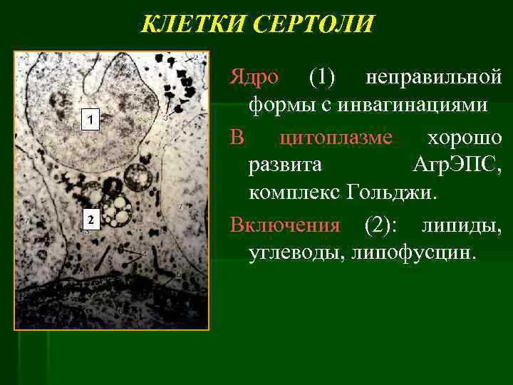 КЛЕТКИ СЕРТОЛИ 1 2 Ядро (1) неправильной формы с инвагинациями В цитоплазме хорошо развита