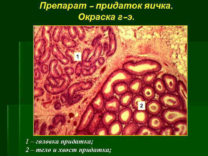 Препарат - придаток яичка. Окраска г-э. 1 2 1 – головка придатка; 2 –