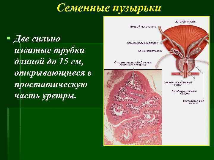 Воспаление семенного мужчин. Проток семенного пузырька анатомия. Предстательная железа и семенные пузырьки анатомия. Слизистой оболочке семенного пузырька свойственно. Семенные пузырьки строение.