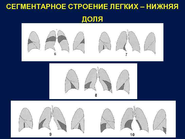 Ателектазы рентген схема