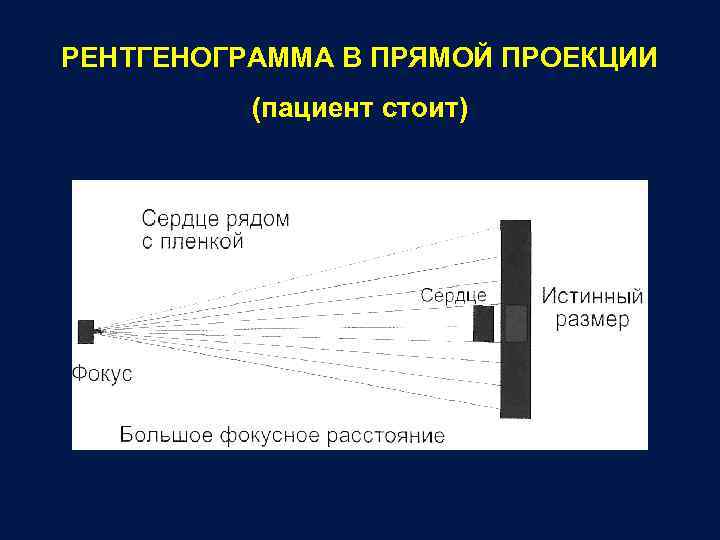 РЕНТГЕНОГРАММА В ПРЯМОЙ ПРОЕКЦИИ (пациент стоит) 