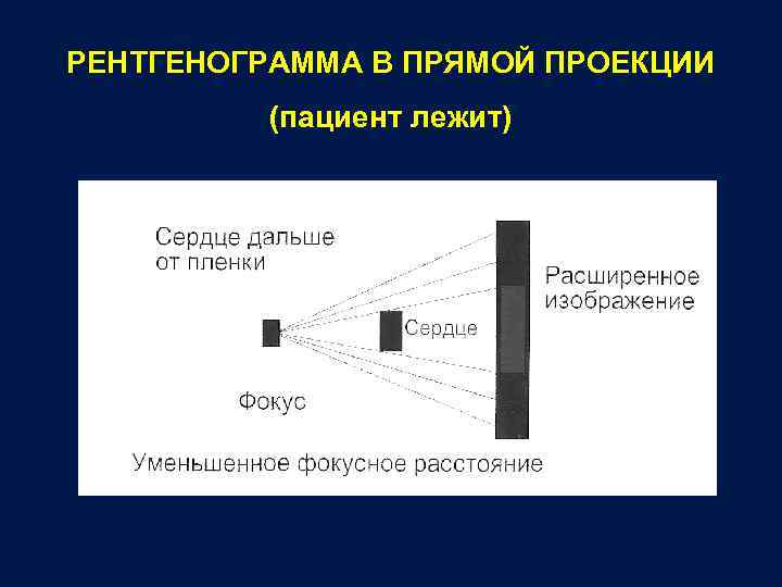 РЕНТГЕНОГРАММА В ПРЯМОЙ ПРОЕКЦИИ (пациент лежит) 