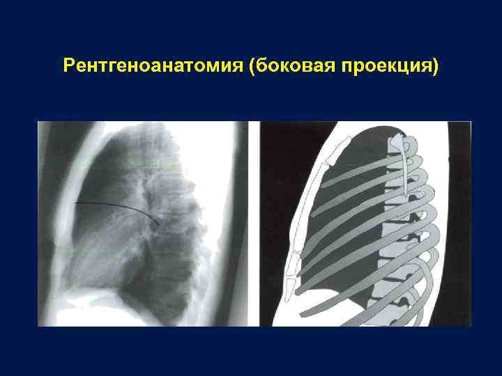 Рентгеноанатомия (боковая проекция) 