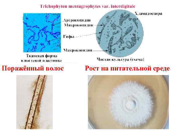 Поражённый волос  Рост на питательной среде 