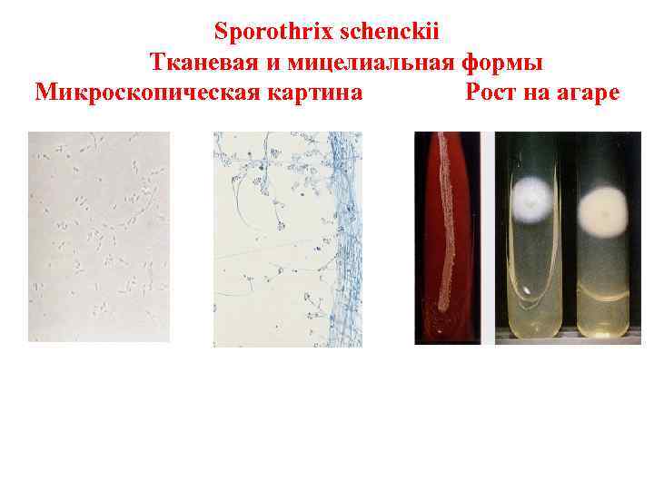    Sporothrix schenckii   Тканевая и мицелиальная формы Микроскопическая картина 