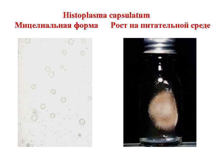    Histoplasma capsulatum Мицелиальная форма  Рост на питательной среде 