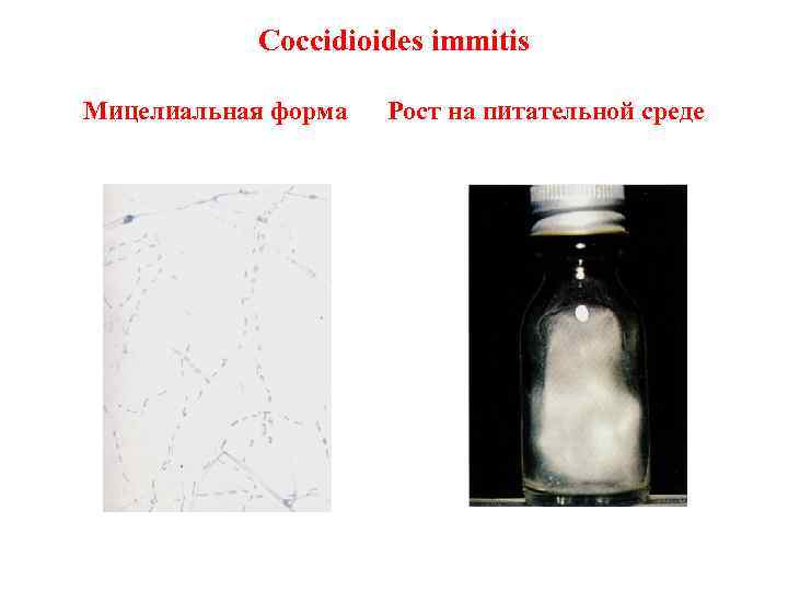   Coccidioides immitis Мицелиальная форма  Рост на питательной среде 