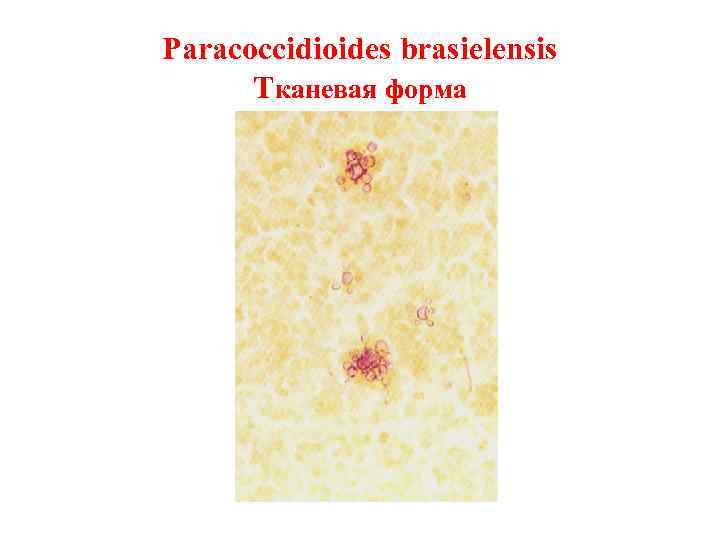 Paracoccidioides brasielensis  Тканевая форма 