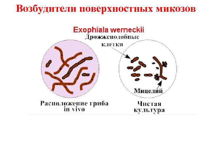 Возбудители поверхностных микозов 
