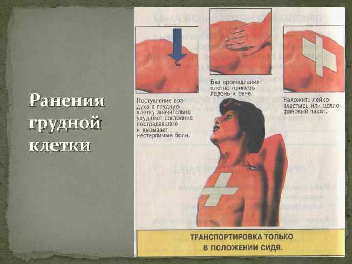 Ранения грудной клетки 