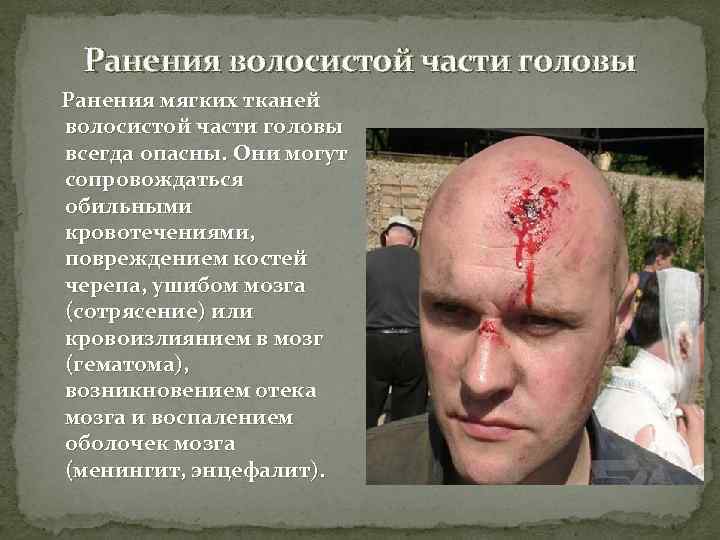  Ранения волосистой части головы Ранения мягких тканей волосистой части головы всегда опасны. Они