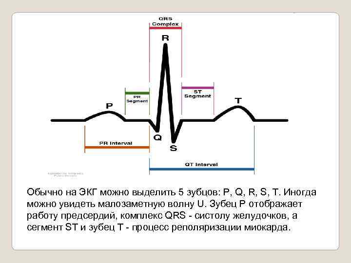 Обычно на ЭКГ можно выделить 5 зубцов: P, Q, R, S, T. Иногда можно