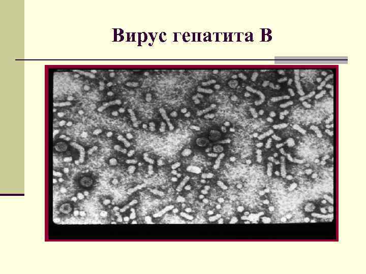 Вирус гепатита В 