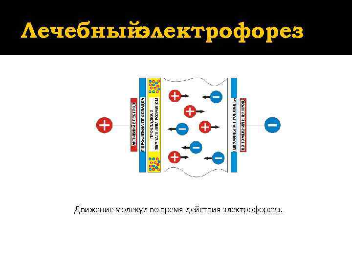 Лечебныйэлектрофорез    .   Движение молекул во время действия электрофореза. 