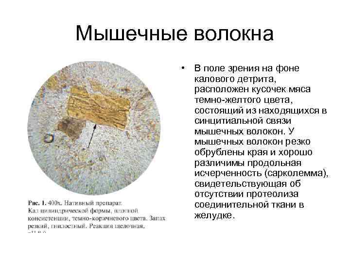 Мышечные волокна   • В поле зрения на фоне  калового детрита, 
