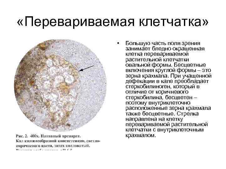 «Перевариваемая клетчатка»    •  Большую часть поля зрения  
