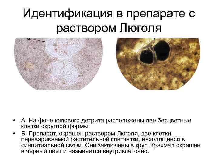   Идентификация в препарате с   раствором Люголя • А. На фоне
