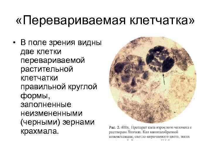  «Перевариваемая клетчатка»  • В поле зрения видны  две клетки  перевариваемой