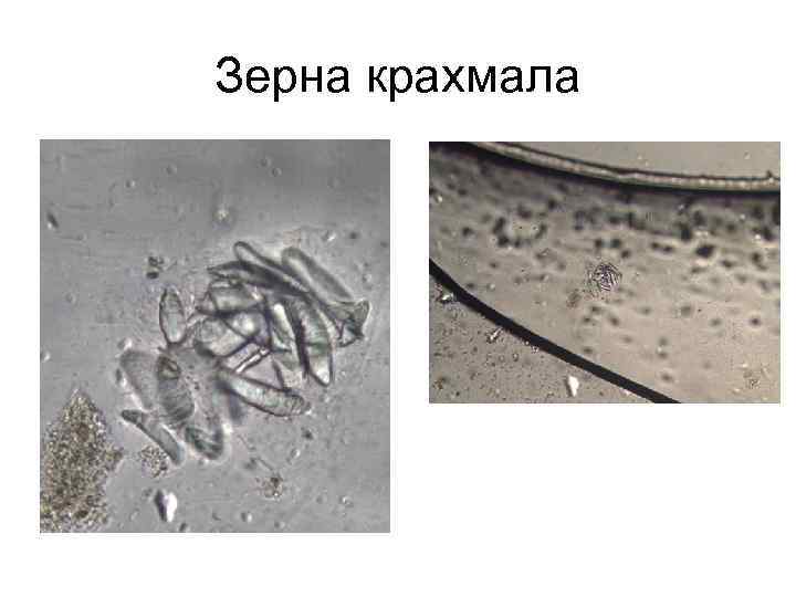 Зерна крахмала 