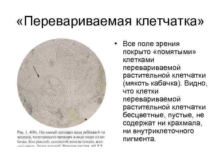  «Перевариваемая клетчатка»    • Все поле зрения    покрыто