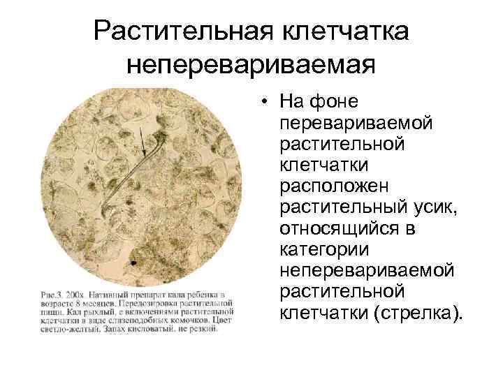 Растительная клетчатка  неперевариваемая   • На фоне   перевариваемой  