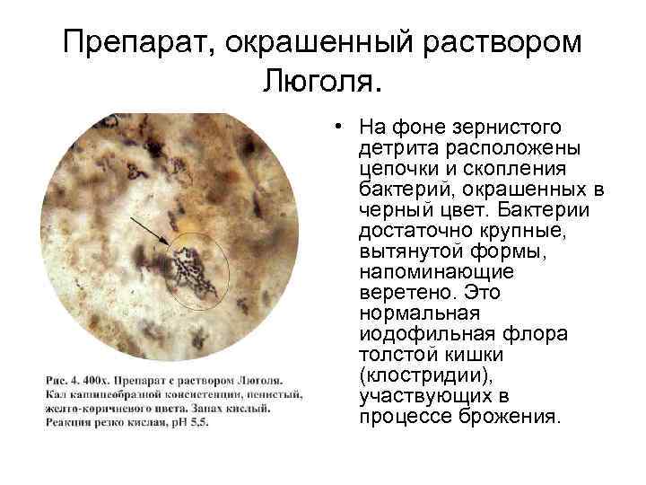 Препарат, окрашенный раствором   Люголя.   • На фоне зернистого  