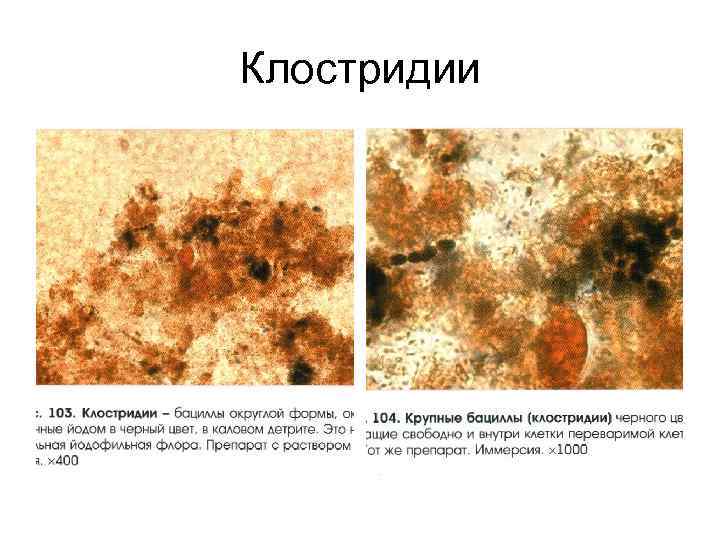 Клостридии 