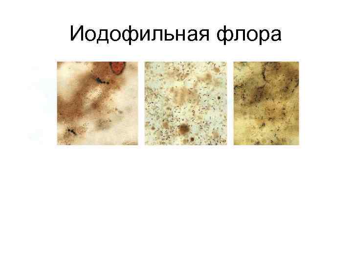 Иодофильная флора 
