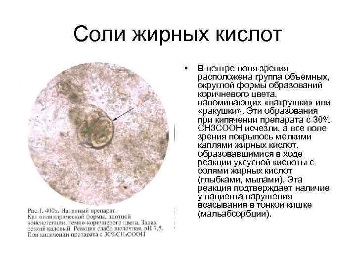 Соли жирных кислот  •  В центре поля зрения   расположена группа