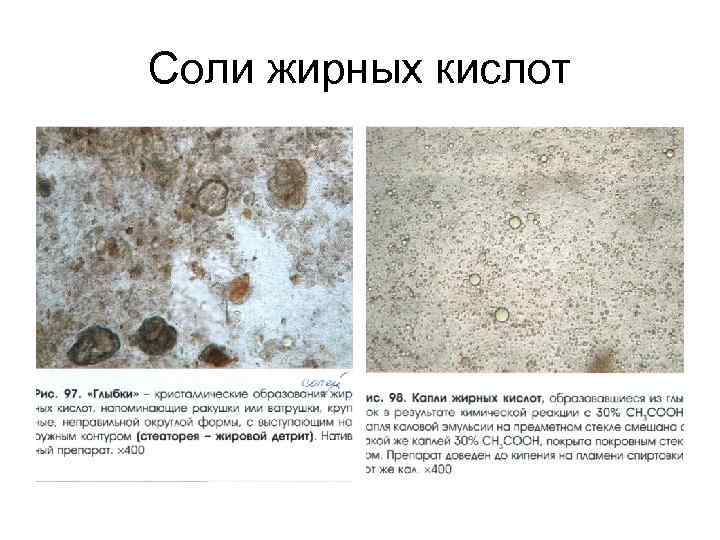 Соли жирных кислот 