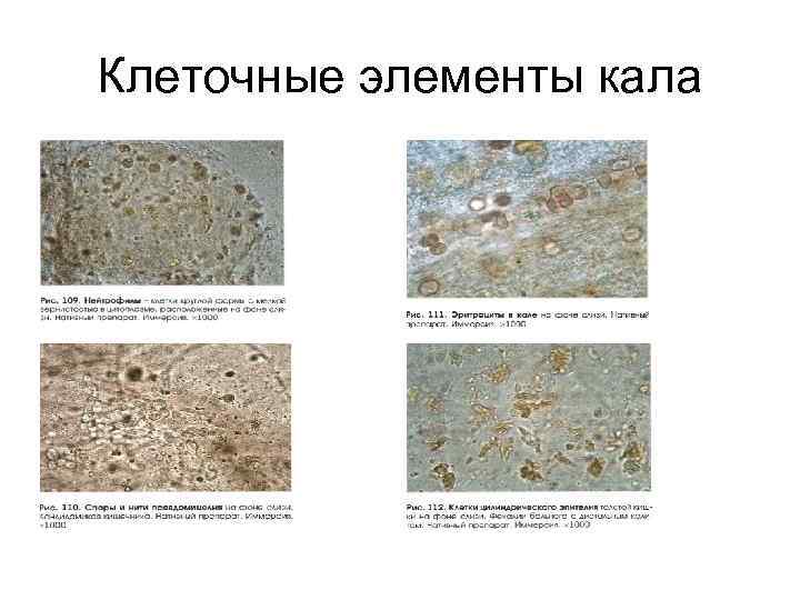 Клеточные элементы кала 