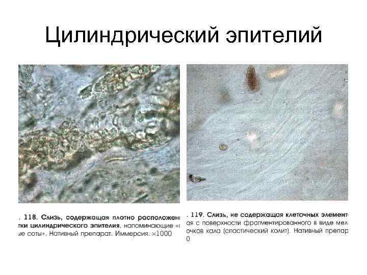 Цилиндрический эпителий 