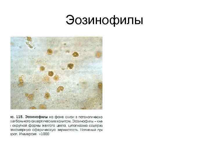 Эозинофилы 