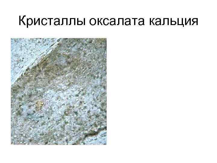Кристаллы оксалата кальция 