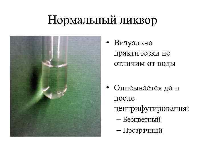 Нормальный ликвор  • Визуально  практически не  отличим от воды  •