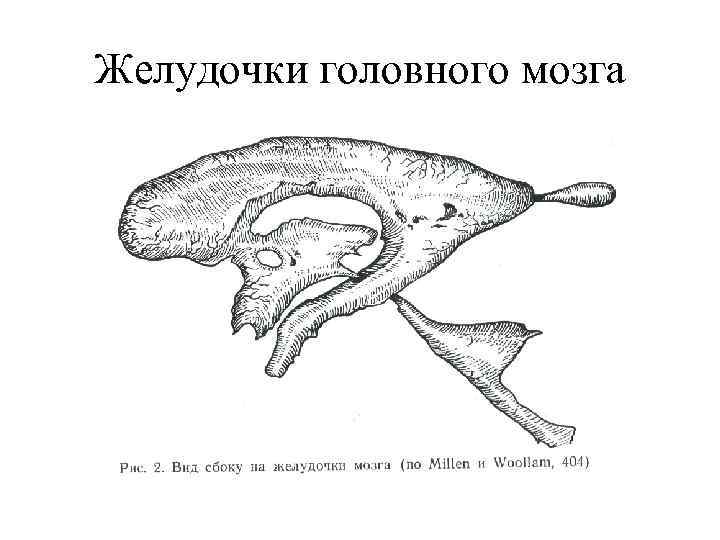 Желудочки головного мозга 