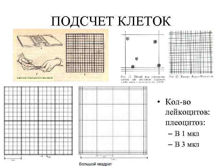 Камера для подсчета клеток в биологических образцах мочи